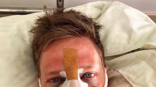 Operazione al naso per Lukas Hofer