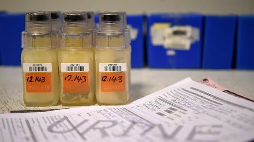 L'Ibu annuncia una seconda positività al Meldonium, farmaco proibito da poche settimane